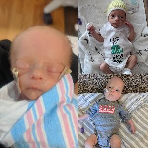 Henry's progression from birth to being home!